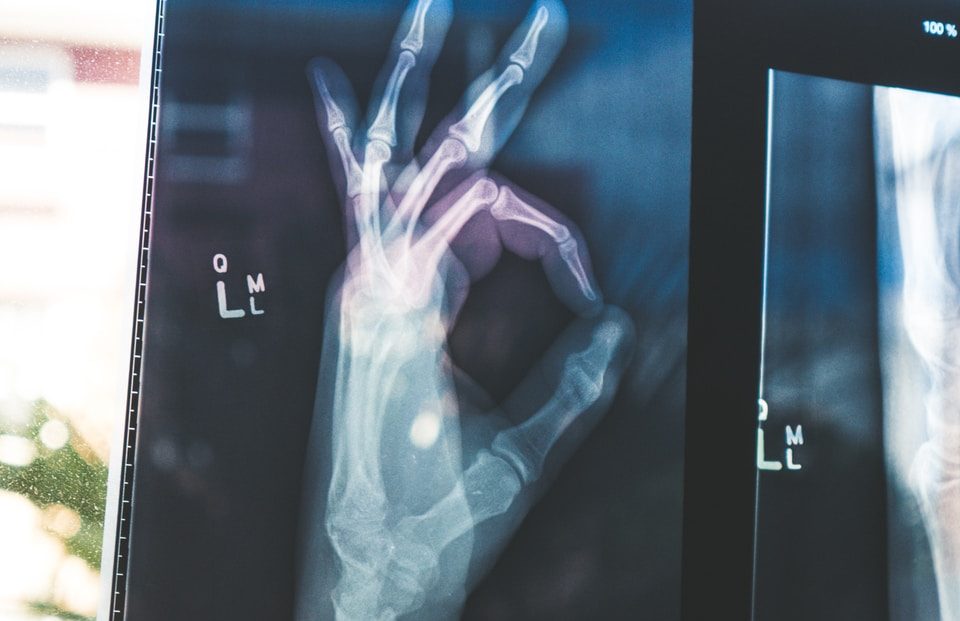 citiscan result hand ok